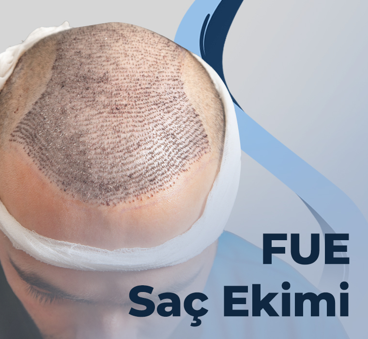 FUE Saç Ekimi