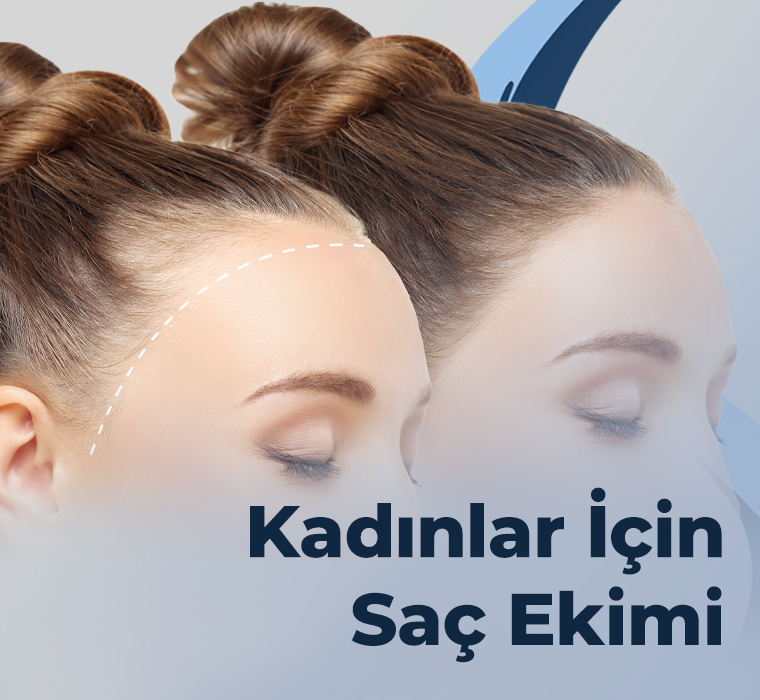 Kadınlar İçin Saç Ekimi