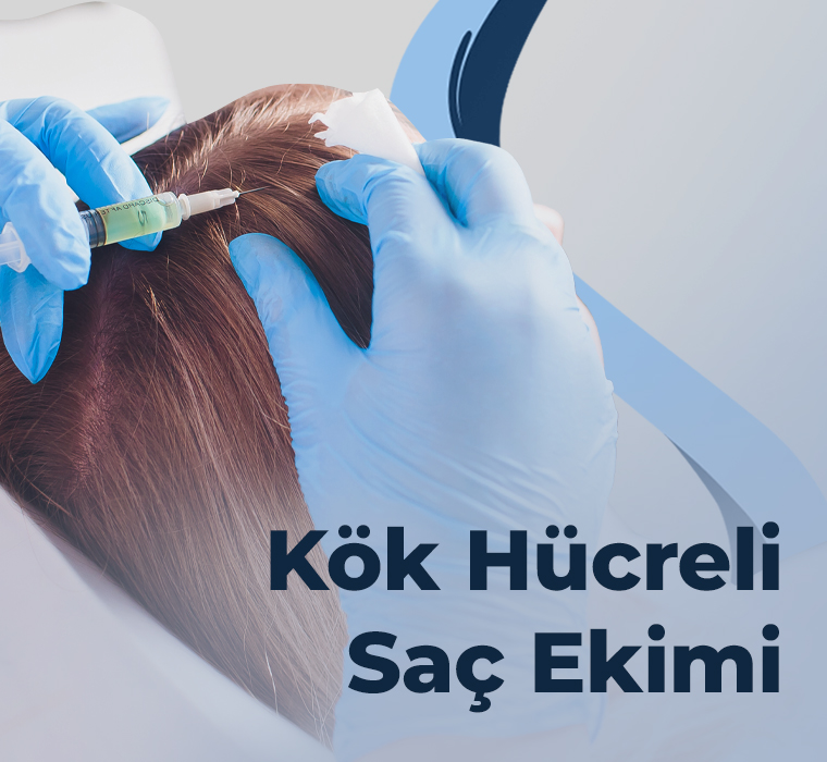Kök Hücreli Saç Ekim