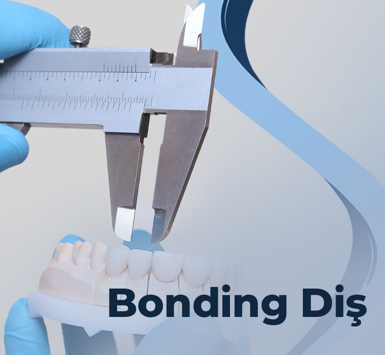 Bonding Diş