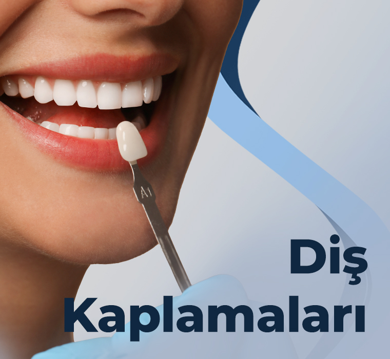 Diş Kaplamaları