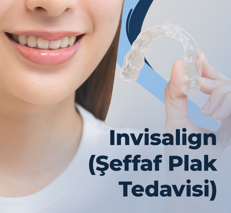 Invisalign (Şeffaf Plak Tedavisi)