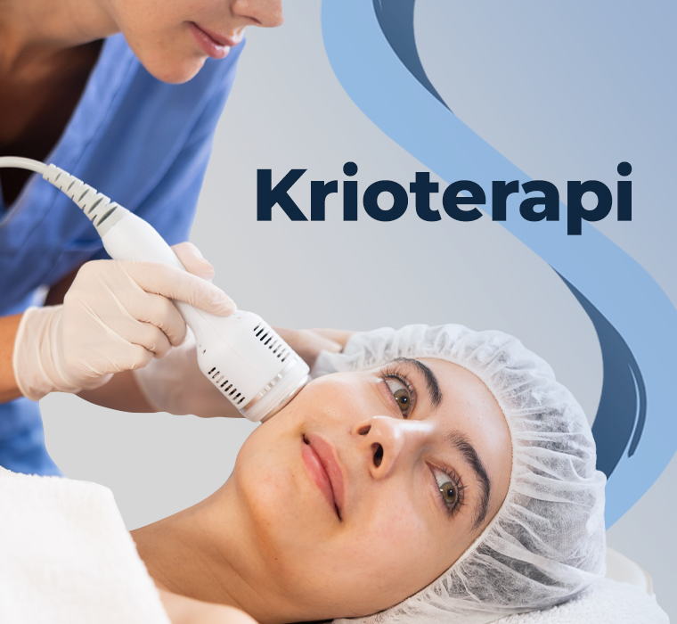 Krioterapi