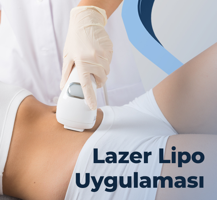 Lazer Lipo Uygulaması