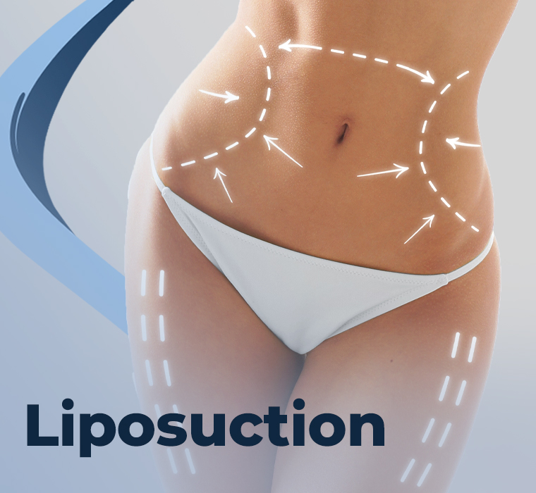 Liposuction