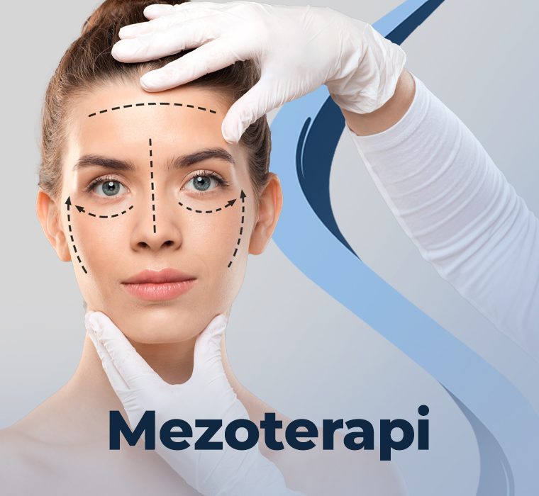 Mezoterapi