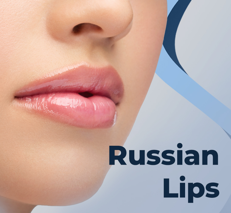Russian Lips