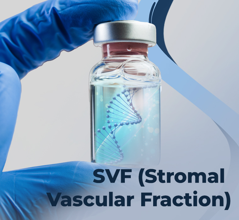 SVF (Stromal Vascular Fraction)