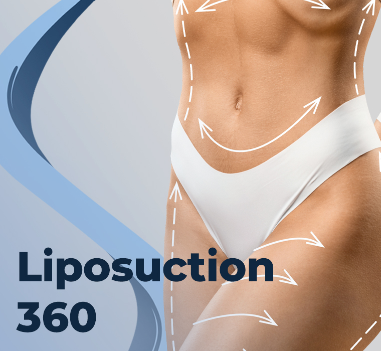 Liposuction 360