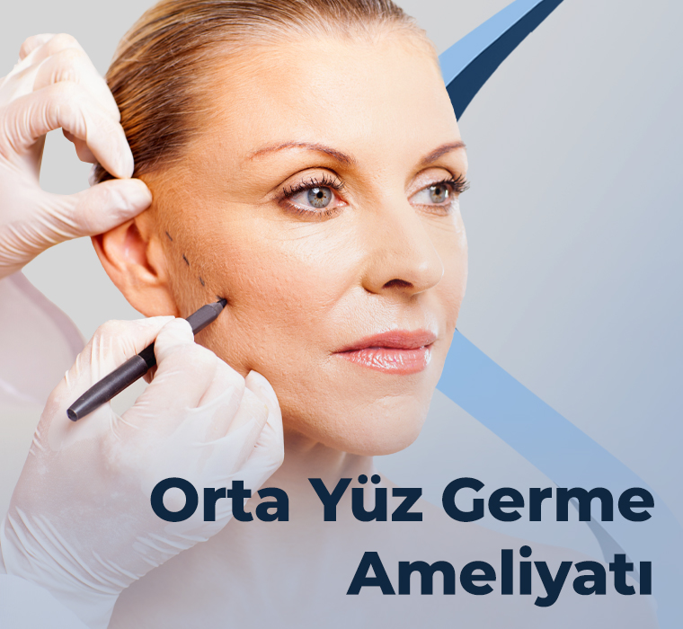 Orta Yüz Germe Cerrahisi