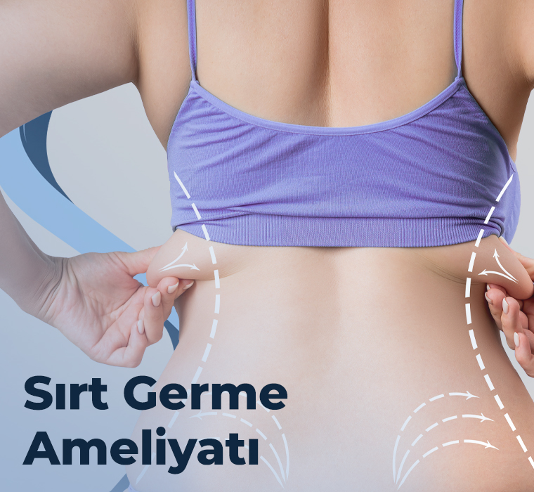 Sırt Germe Ameliyatı