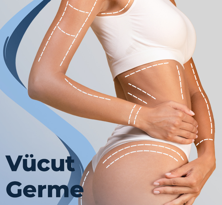 Vücut Germe