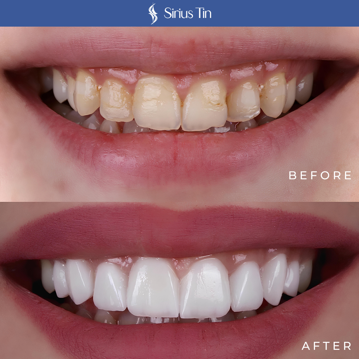 DENTISTRY BEFORE/AFTER1