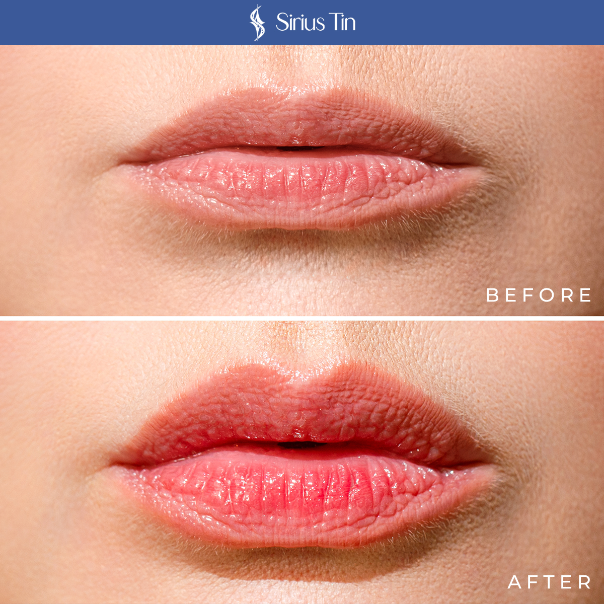 MEDICAL AESTHETIC BEFORE/AFTER1